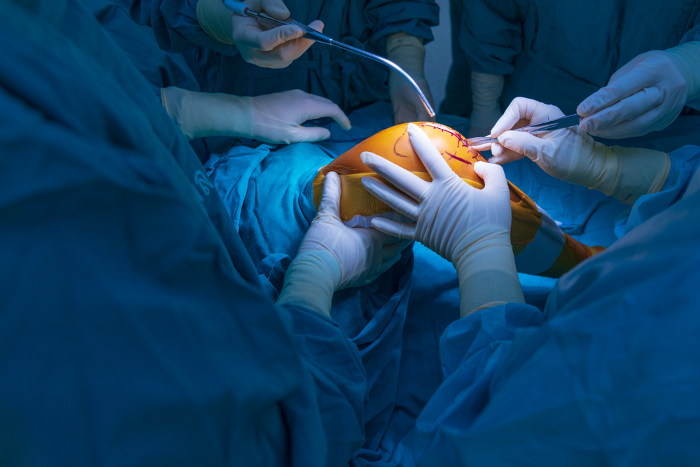 Knee Replacement Surgery