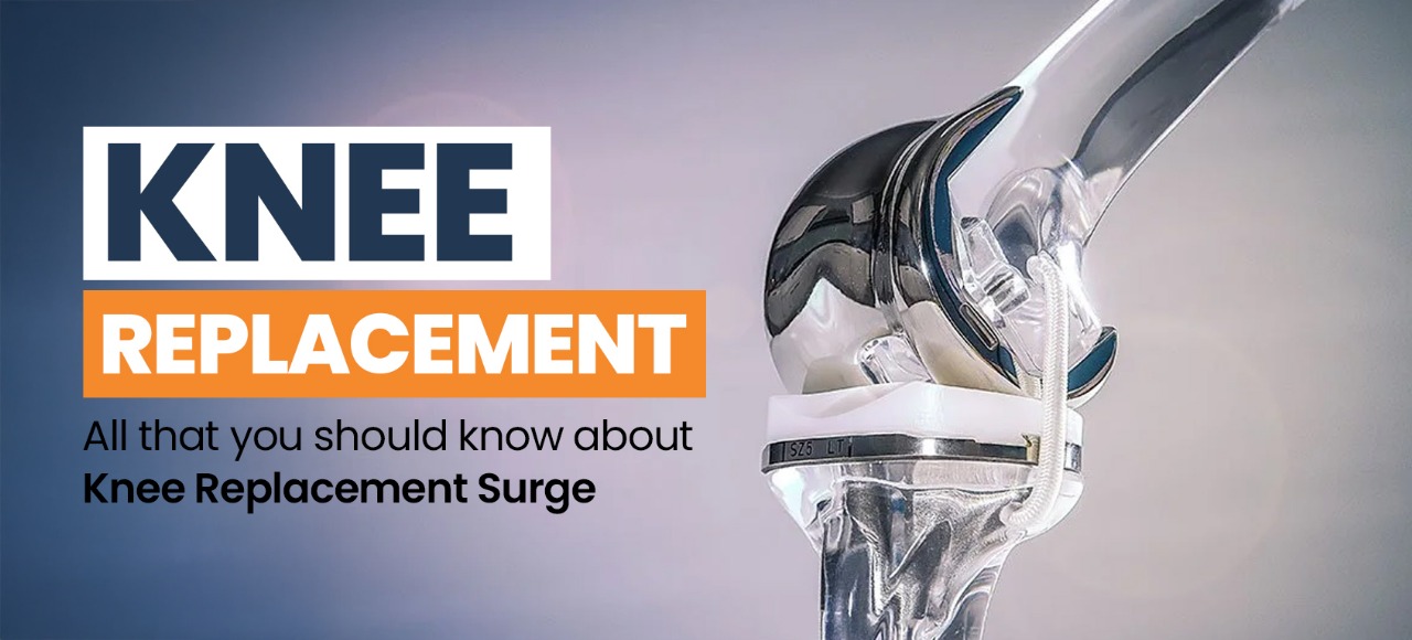 Knee replacement- All that you should know about Knee Replacement Surgery