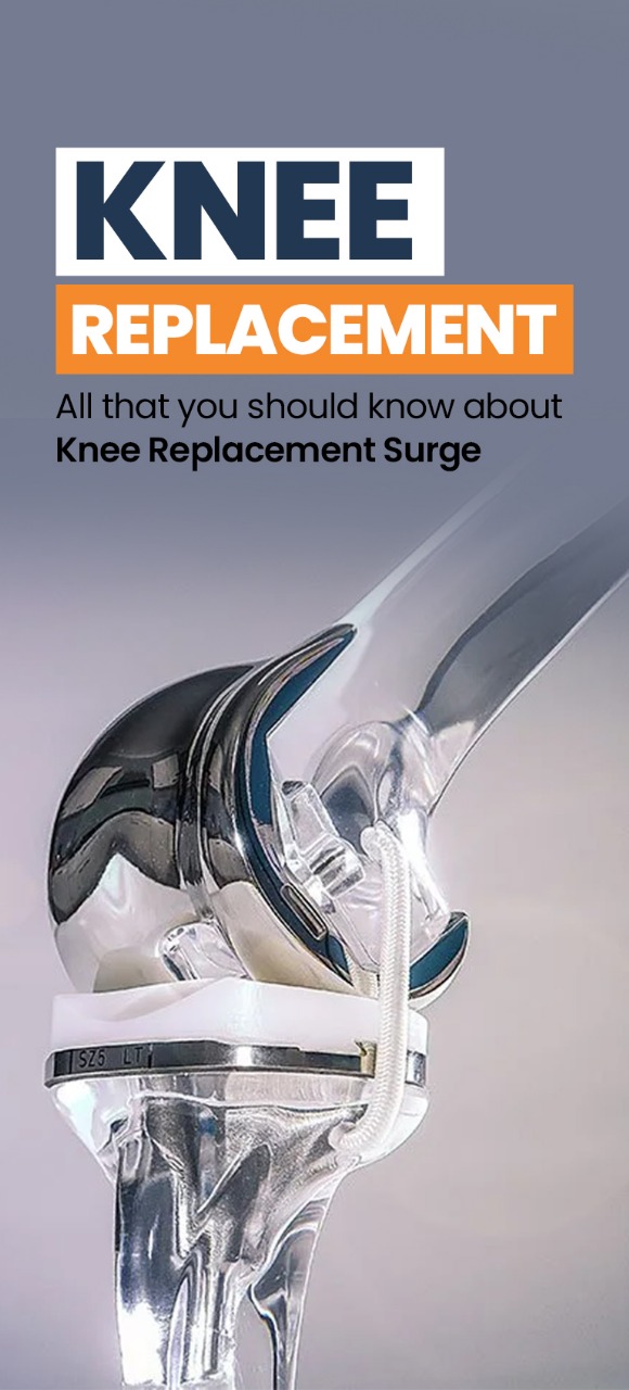 Knee replacement- All that you should know
