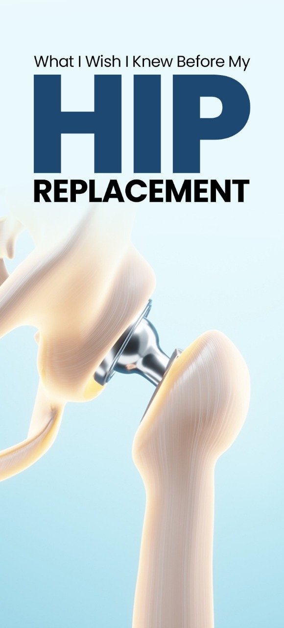 Hip Replacement