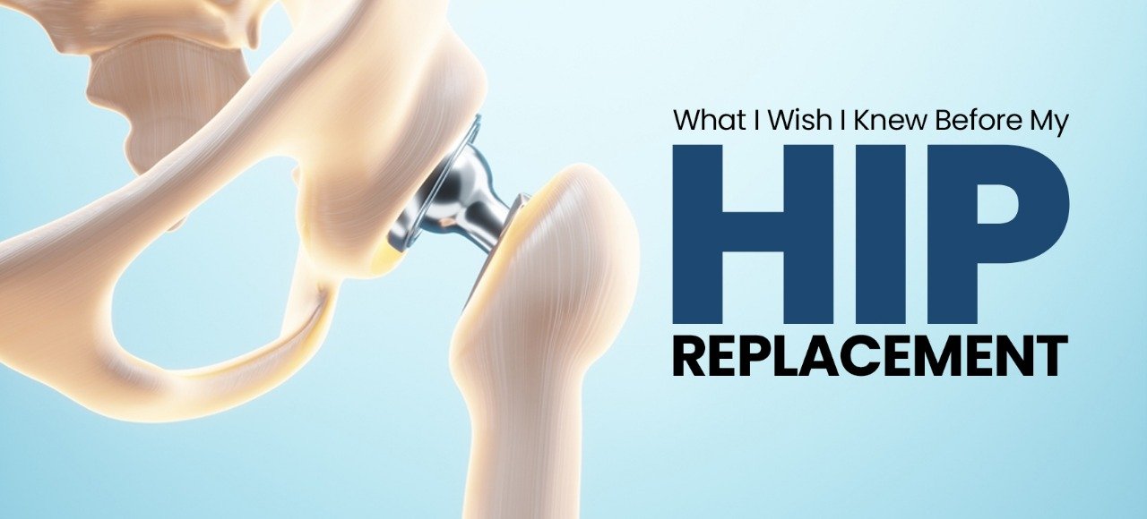 What I Wish I Knew Before My Hip Replacement